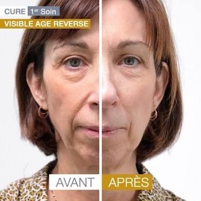 Visible Age Reverse
